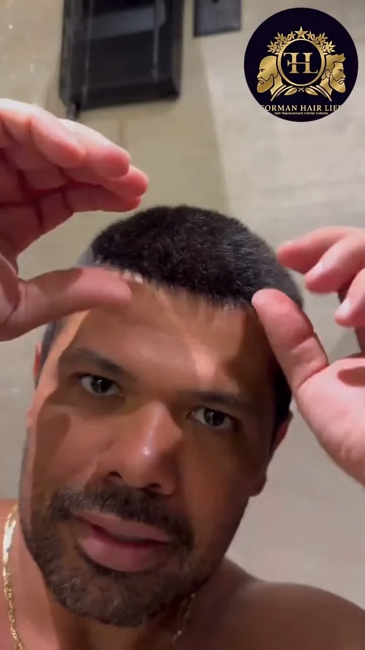 Hair patch tapping system